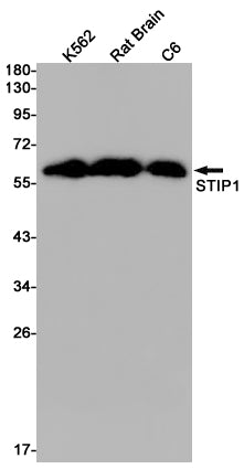 STIP1 (16V12) Rabbit Monoclonal Antibody