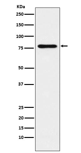 SUN2 (18Q3) Rabbit Monoclonal Antibody