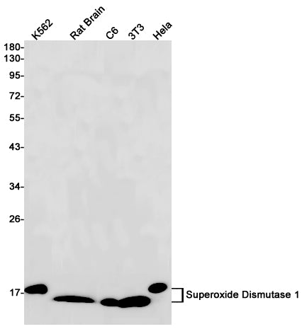 Superoxide Dismutase 1 (10Y2) Rabbit Monoclonal Antibody