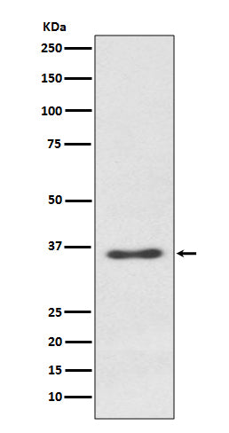 Syndecan 1 (9L3) Rabbit Monoclonal Antibody