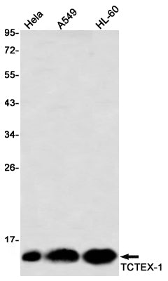 TCTEX1 (7I4) Rabbit Monoclonal Antibody