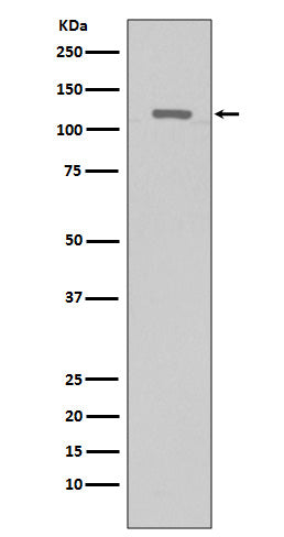 TERT (9Y18) Rabbit Monoclonal Antibody