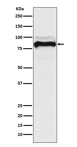 TGF beta Receptor II (17K1) Rabbit Monoclonal Antibody