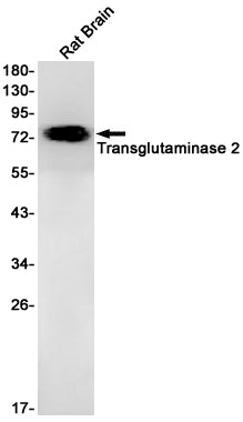 TGM2 (5V19) Rabbit Monoclonal Antibody