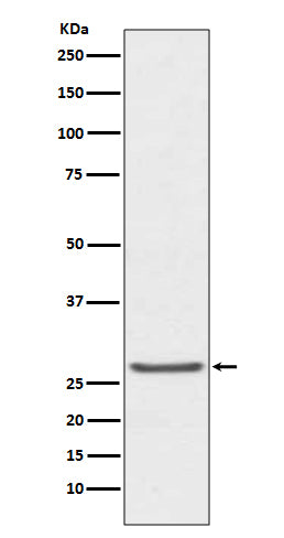 TIMP1 (9Y15) Rabbit Monoclonal Antibody