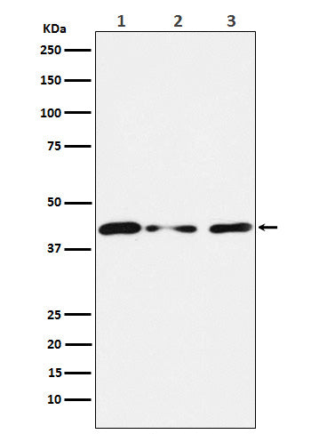 Tin2 (16N6) Rabbit Monoclonal Antibody