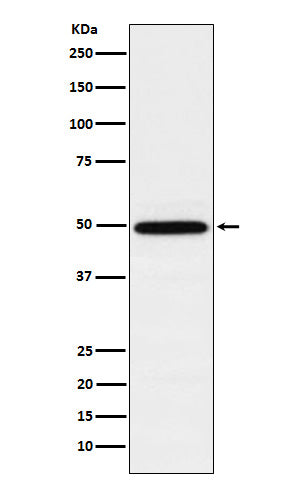 TIP49A (9Z11) Rabbit Monoclonal Antibody