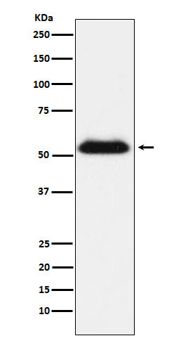 TMPRSS2 (6M19) Rabbit Monoclonal Antibody