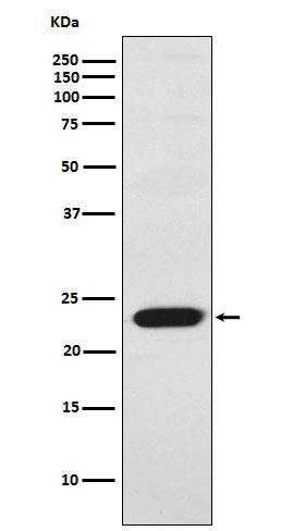 TNNI2 (3O11) Rabbit Monoclonal Antibody