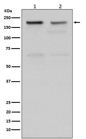 Topoisomerase II alpha (2J12) Rabbit Monoclonal Antibody
