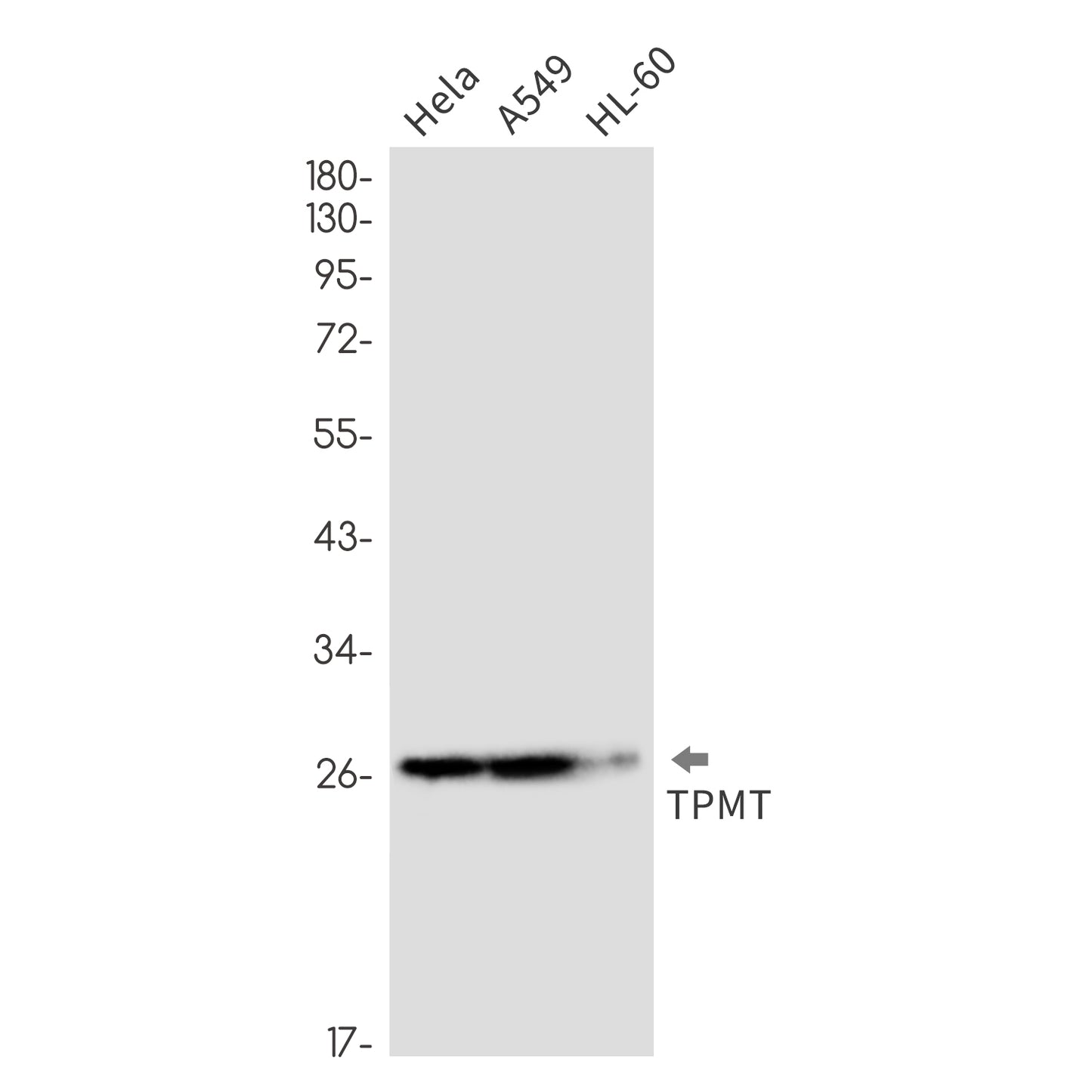 TPMT (3H2) Rabbit Monoclonal Antibody
