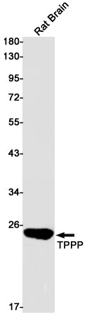 TPPP (5H10) Rabbit Monoclonal Antibody