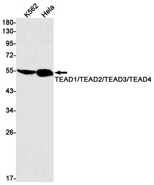 Transcriptional Enhancer Factor TEF (14G4) Rabbit Monoclonal Antibody