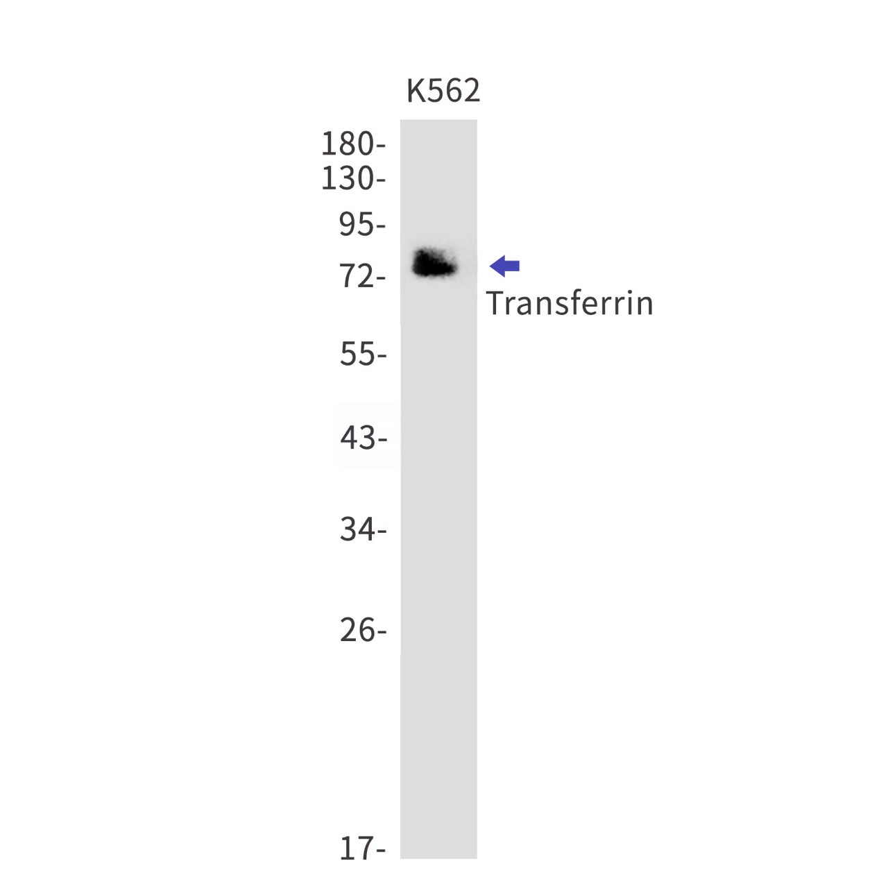Transferrin (19H12) Rabbit Monoclonal Antibody
