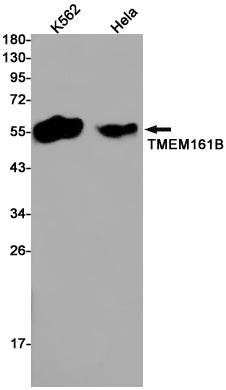 Transmembrane Protein 161B (19D14) Rabbit Monoclonal Antibody