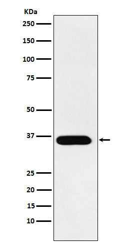 TRAP (12F3) Rabbit Monoclonal Antibody