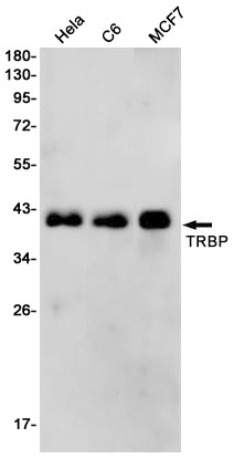 TRBP (8B1) Rabbit Monoclonal Antibody