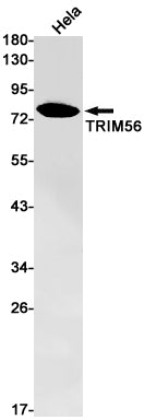 TRIM56 (5Y14) Rabbit Monoclonal Antibody