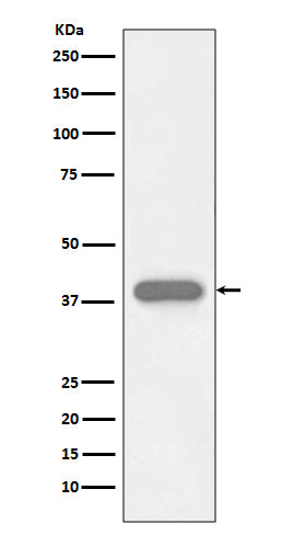 Troponin T (15D11) Rabbit Monoclonal Antibody