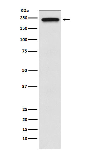 TRPM7 (15L9) Rabbit Monoclonal Antibody