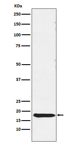 TSH beta (11Y4) Rabbit Monoclonal Antibody