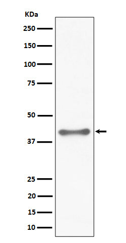 TTF1 (17D1) Rabbit Monoclonal Antibody
