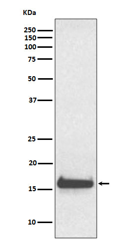 TTR (2S19) Rabbit Monoclonal Antibody