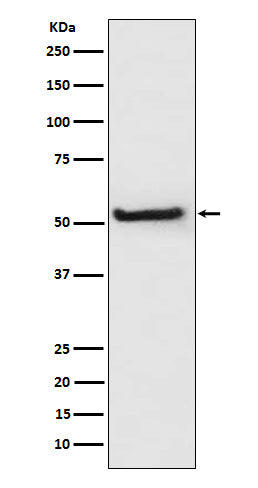 TXNIP (15D1) Rabbit Monoclonal Antibody