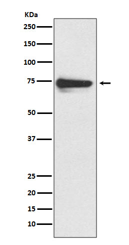 Tyrosinase (8Z10) Rabbit Monoclonal Antibody