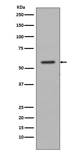 Tyrosine Hydroxylase (15J18) Rabbit Monoclonal Antibody