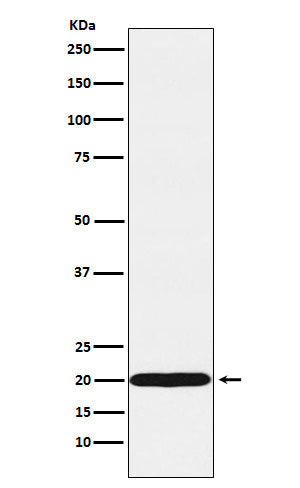 UBE2C (1N15) Rabbit Monoclonal Antibody