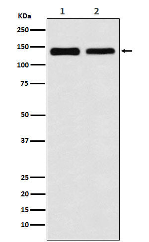 UBE4B (1H16) Rabbit Monoclonal Antibody