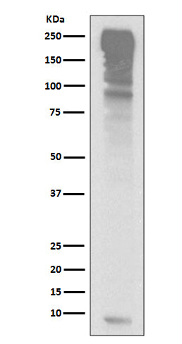 Ubiquitin (2O5) Rabbit Monoclonal Antibody