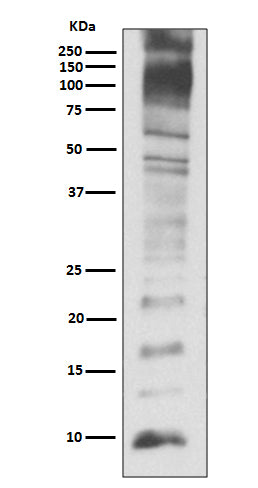 Ubiquitin (3V19) Rabbit Monoclonal Antibody