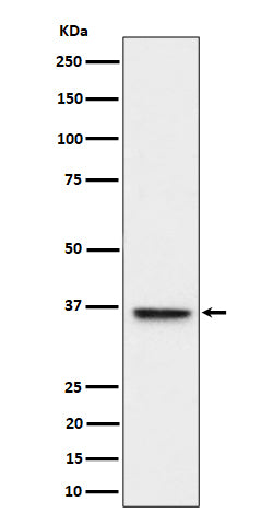 ULBP1 (3U10) Rabbit Monoclonal Antibody