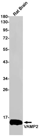 VAMP2 (3Z10) Rabbit Monoclonal Antibody