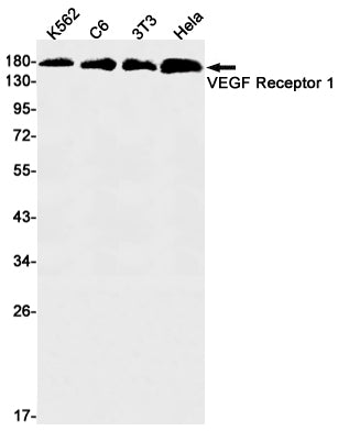 VEGF Receptor 1 (16I17) Rabbit Monoclonal Antibody