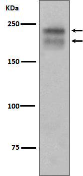 VEGF Receptor 2 (7X12) Rabbit Monoclonal Antibody
