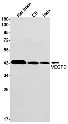VEGFD (7C13) Rabbit Monoclonal Antibody
