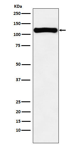 VPS11 (1S10) Rabbit Monoclonal Antibody