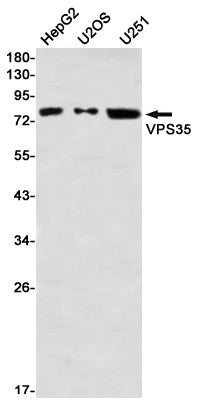 VPS35 (6J12) Rabbit Monoclonal Antibody