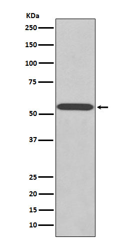 Wilms Tumor Protein (13C17) Rabbit Monoclonal Antibody
