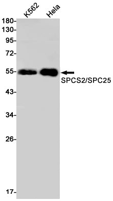 WTAP (4C15) Rabbit Monoclonal Antibody