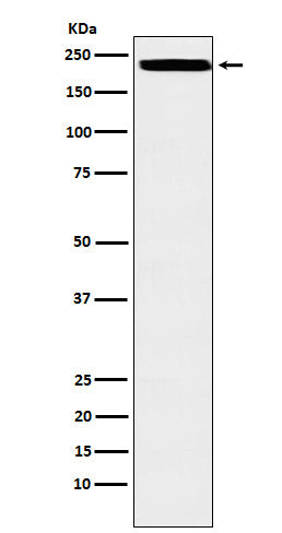 ZEB1 (16B4) Rabbit Monoclonal Antibody