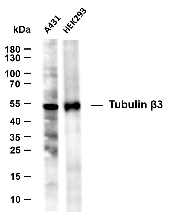 Tubulin beta-3 (12Z6) Rabbit Monoclonal Antibody