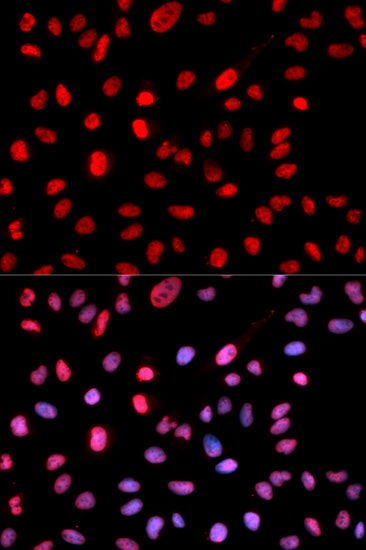 Phospho-DNMT1-S714 Rabbit pAb