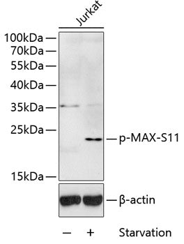 Phospho-MAX-S11 Rabbit pAb