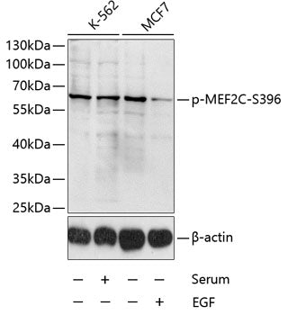 Phospho-MEF2C-S396 Rabbit pAb