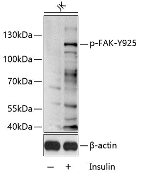 Phospho-FAK-Y925 Rabbit pAb