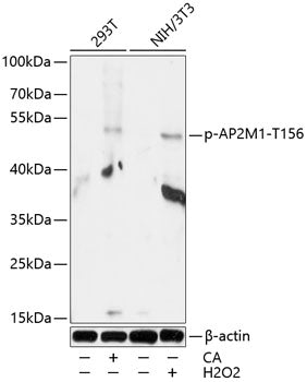 Phospho-AP2M1-T156 Rabbit pAb